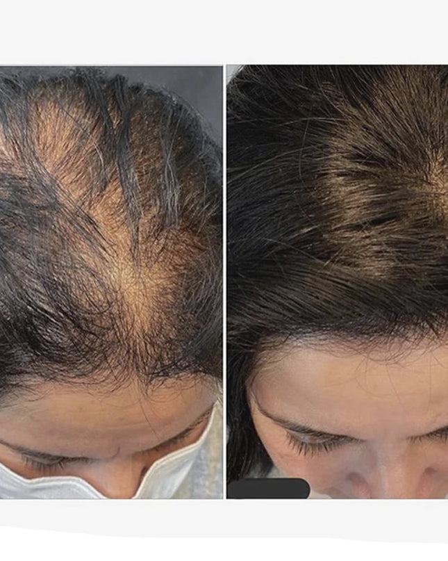 6x6 inch Human Hair Silk Topper With 2CM PU Around Virgin Human Hair Topper Straight For Women